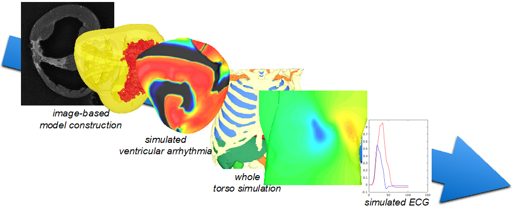 Virtual pace mapping for optimised planning of catheter ablation ...